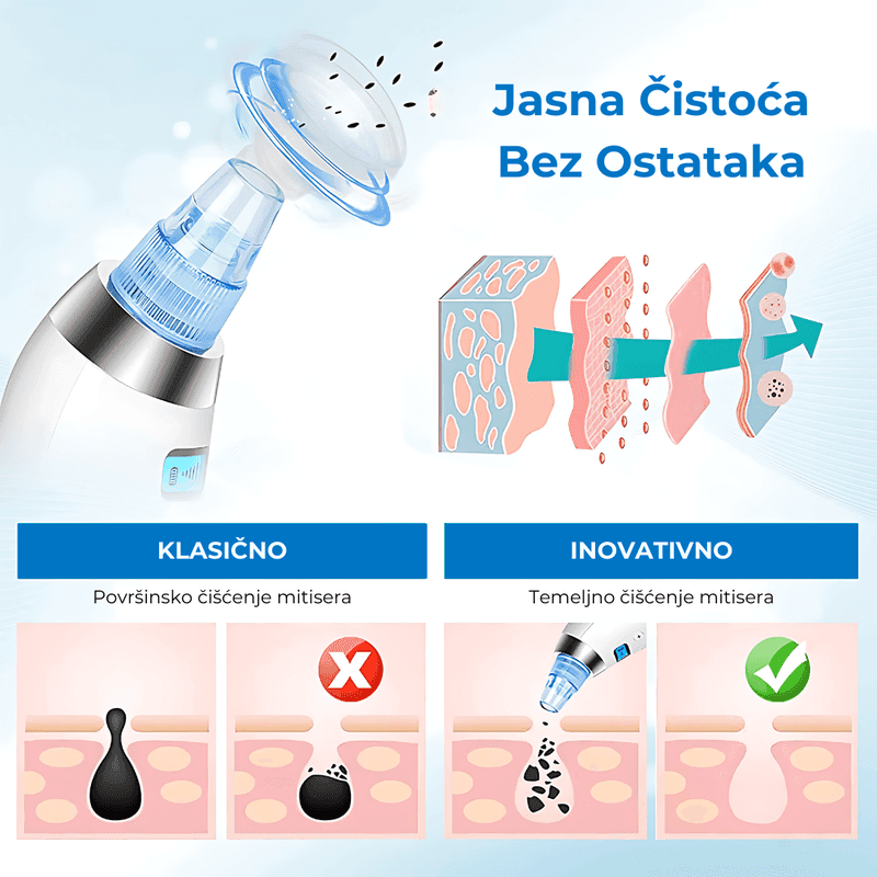 vakumski čistač pora — detalji